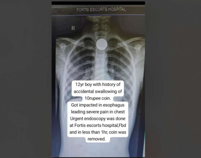 Fortis Escorts Faridabad